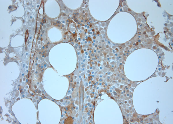 CD36 Antibody in Immunohistochemistry (Paraffin) (IHC (P))