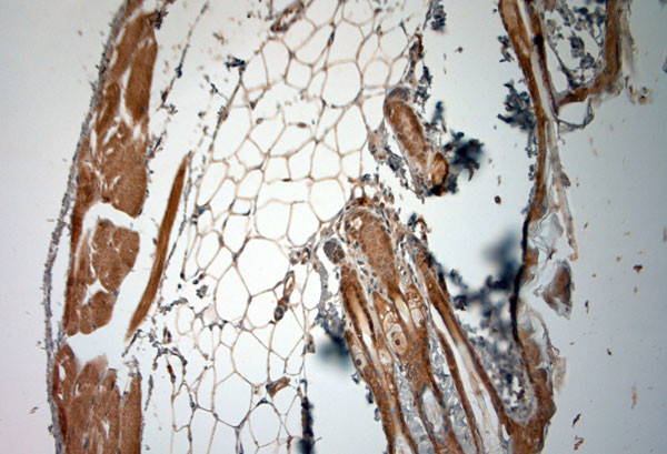 Collagen VII Antibody in Immunohistochemistry (Paraffin) (IHC (P))