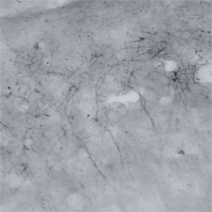 DFNA5 homolog Antibody in Immunohistochemistry (IHC)