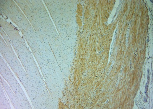 DRAM Antibody in Immunohistochemistry (Paraffin) (IHC (P))