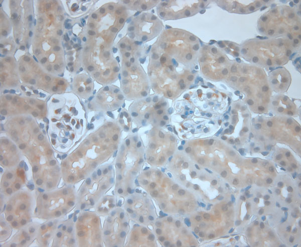 Dectin 2 Antibody in Immunohistochemistry (Paraffin) (IHC (P))