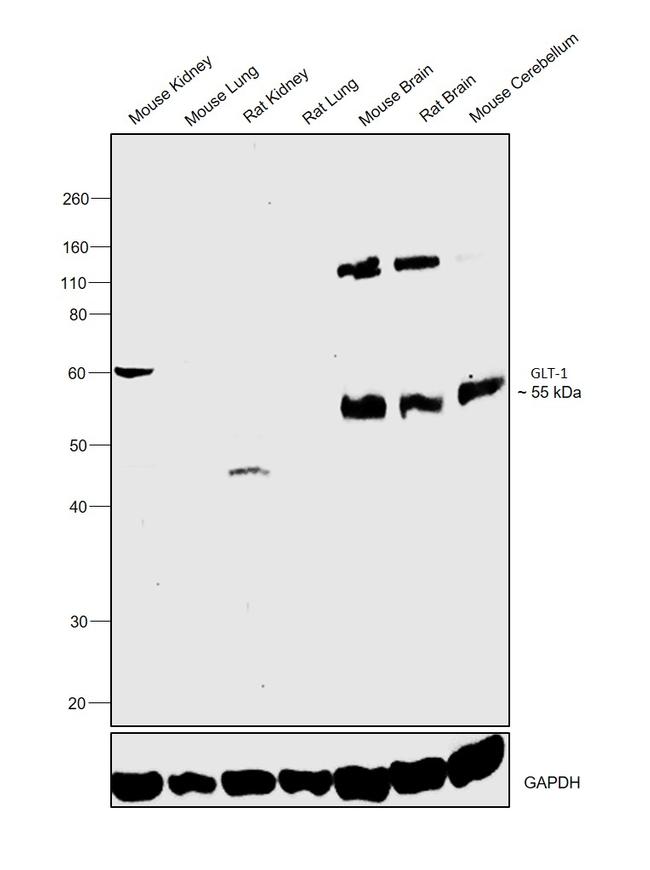 GLT-1 Antibody in Western Blot (WB)
