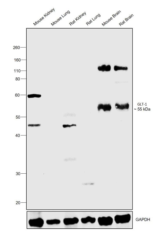 GLT-1 Antibody in Western Blot (WB)