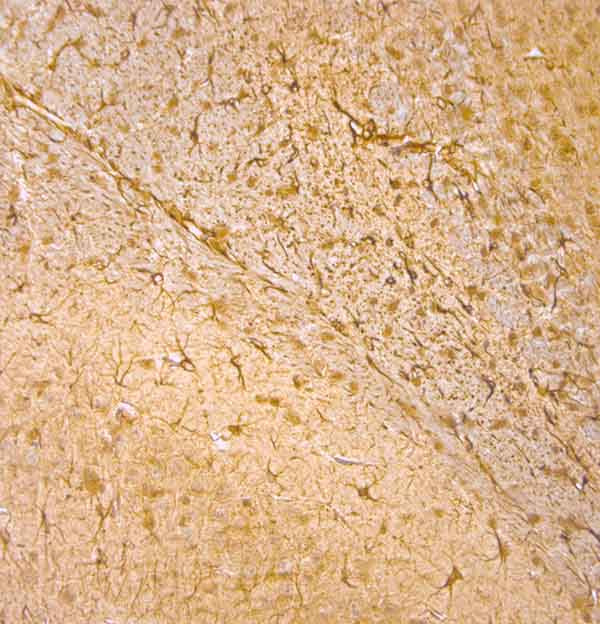 GFAP Antibody in Immunohistochemistry (Paraffin) (IHC (P))