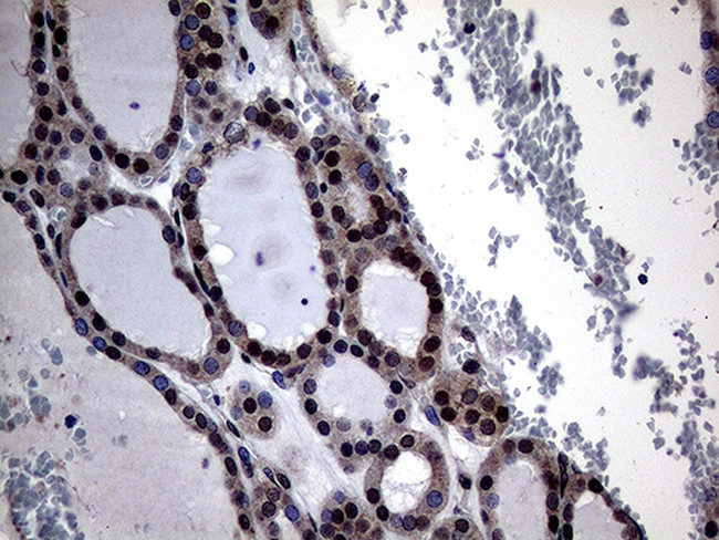 OSGIN2 Antibody in Immunohistochemistry (Paraffin) (IHC (P))
