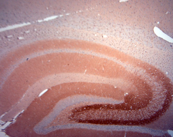 HOMER3 Antibody in Immunohistochemistry (Paraffin) (IHC (P))