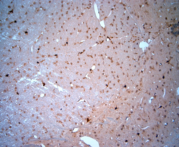LIMD2 Antibody in Immunohistochemistry (Paraffin) (IHC (P))