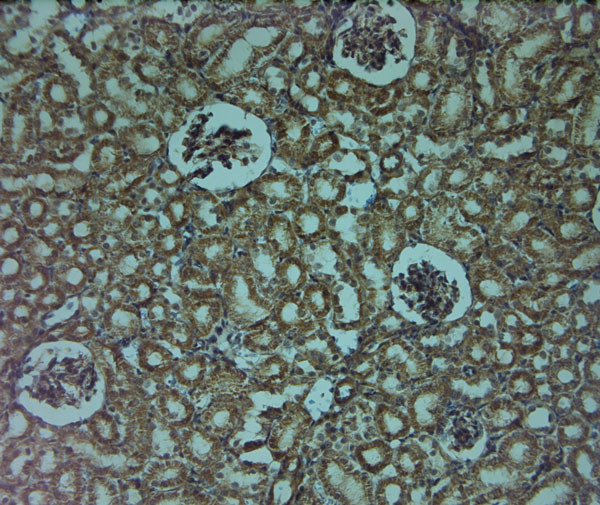 Mitofusin 2 Antibody in Immunohistochemistry (Paraffin) (IHC (P))