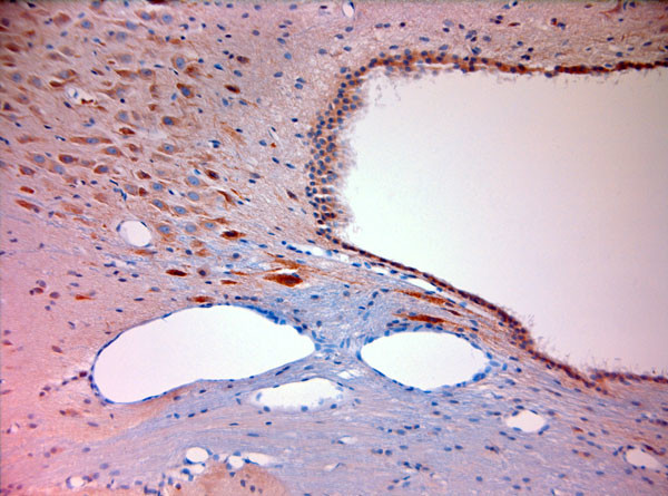 Mortalin Antibody in Immunohistochemistry (Paraffin) (IHC (P))