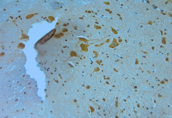 MPP4 Antibody in Immunohistochemistry (Paraffin) (IHC (P))