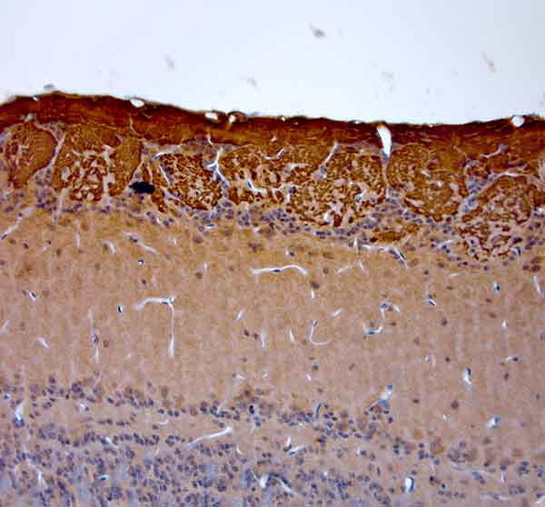 OMP Antibody in Immunohistochemistry (Paraffin) (IHC (P))