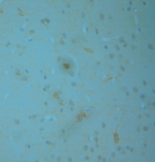 nNOS Antibody in Immunohistochemistry (Paraffin) (IHC (P))