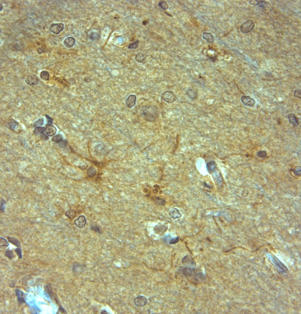 NMDAR3A Antibody in Immunohistochemistry (Paraffin) (IHC (P))