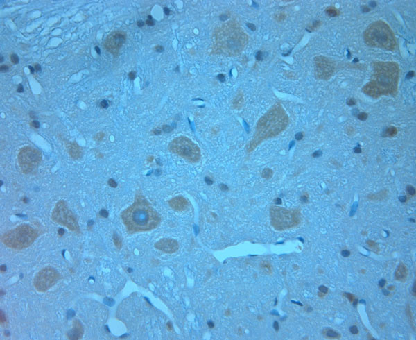 Otoferlin Antibody in Immunohistochemistry (Paraffin) (IHC (P))