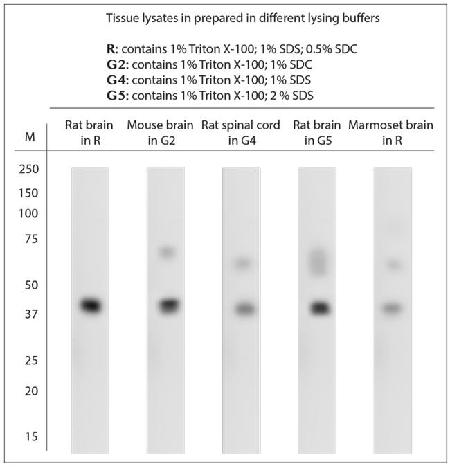 Pejvakin Antibody in Western Blot (WB)