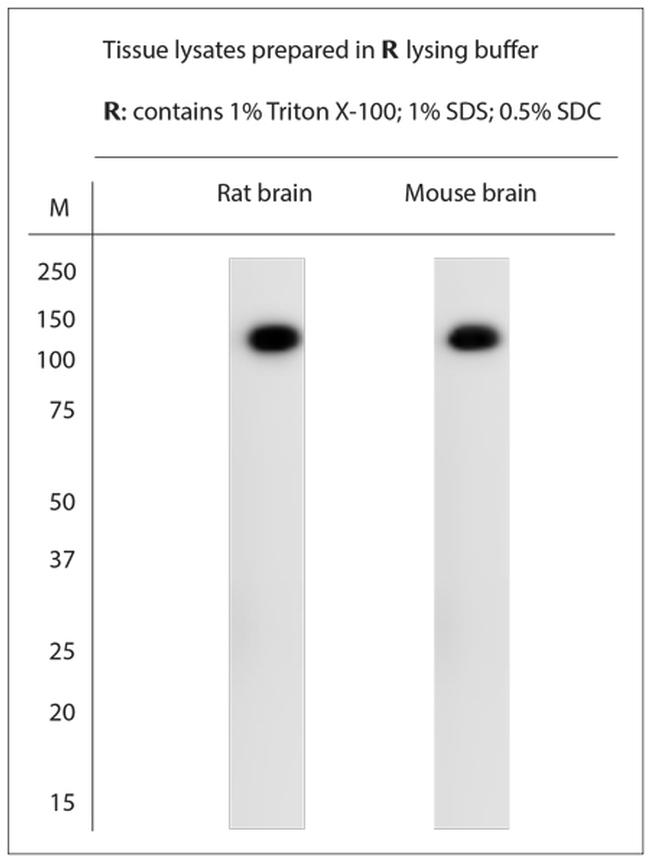 KCNT1 Antibody in Western Blot (WB)