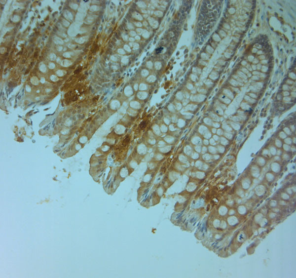 Perilipin 4 Antibody in Immunohistochemistry (Paraffin) (IHC (P))
