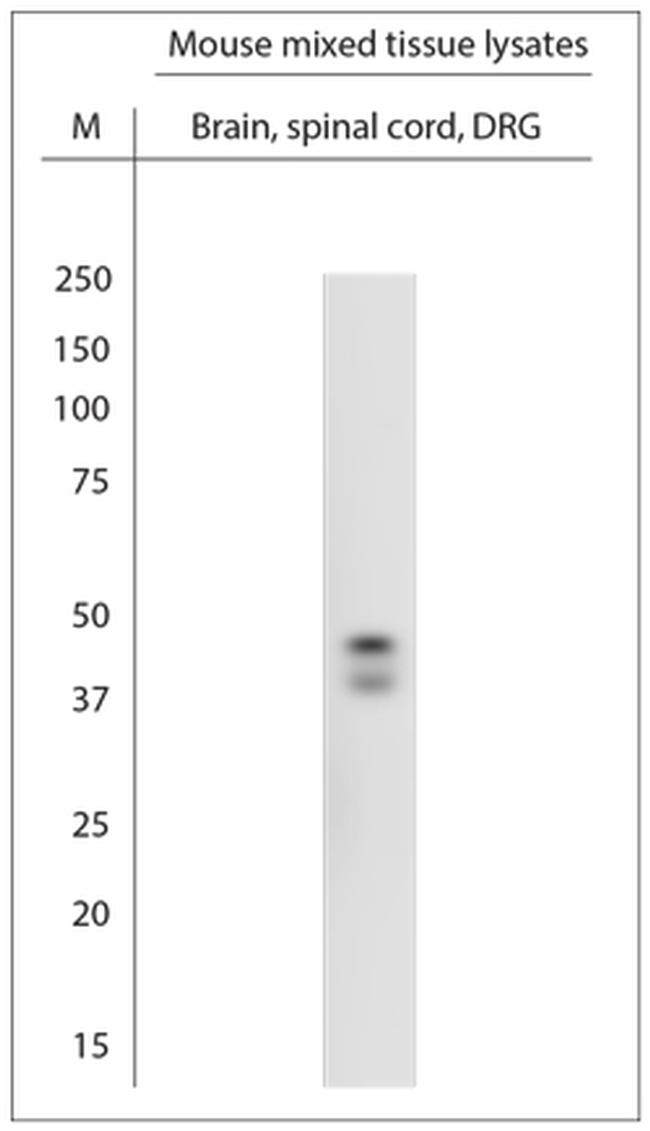 POC1A Antibody in Western Blot (WB)