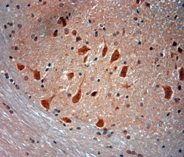 TRPML1 Antibody in Immunohistochemistry (Paraffin) (IHC (P))