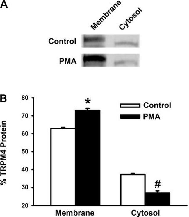 TRPM4 Antibody in Western Blot (WB)