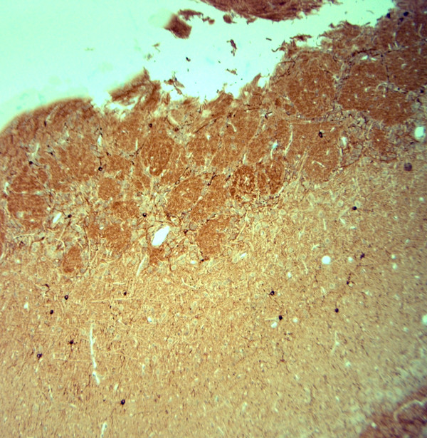 HCN2 Antibody in Immunohistochemistry (Paraffin) (IHC (P))