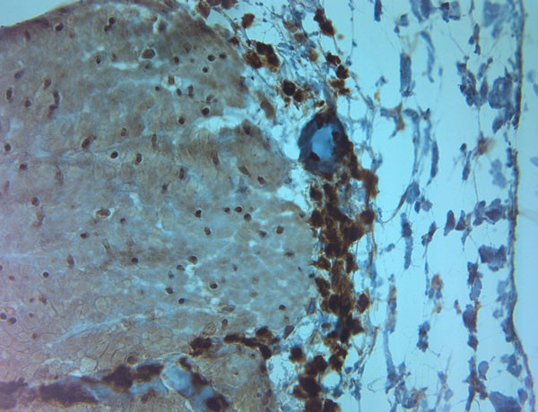 TRPV5 Antibody in Immunohistochemistry (Paraffin) (IHC (P))