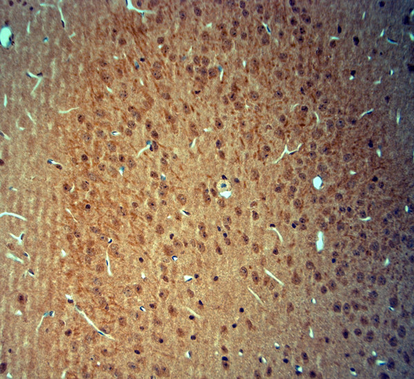 Colon carcinoma laminin binding protein Antibody in Immunohistochemistry (Paraffin) (IHC (P))