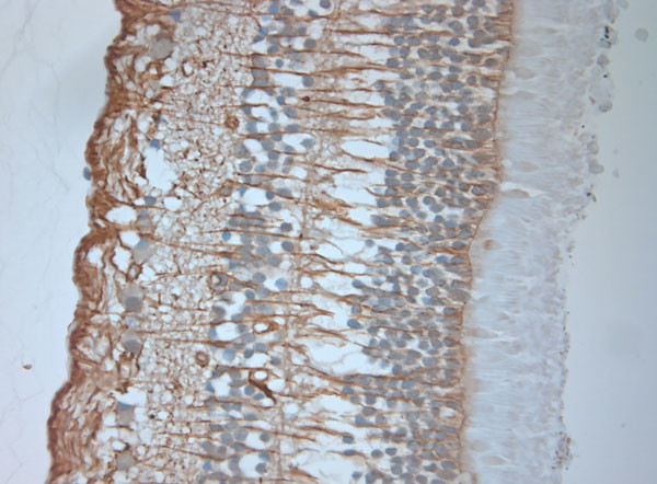 GPR143 Antibody in Immunohistochemistry (Paraffin) (IHC (P))