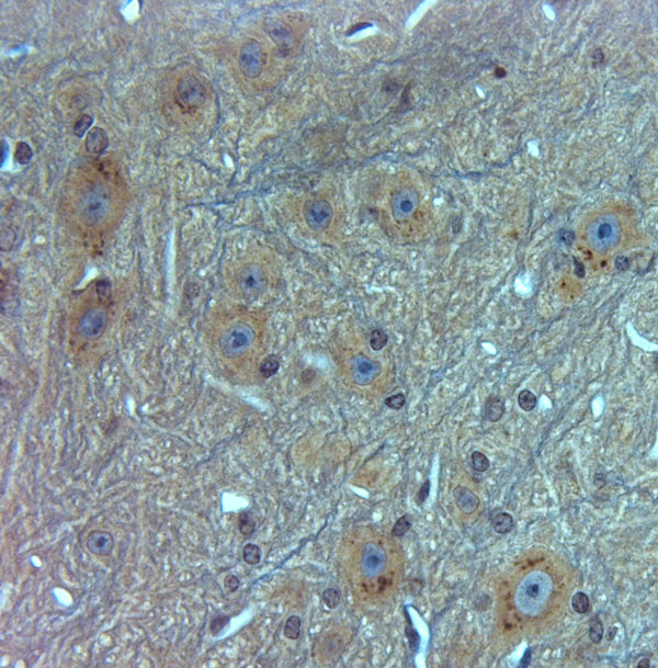 TMC3 Antibody in Immunohistochemistry (Paraffin) (IHC (P))