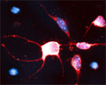 RhoB Antibody in Immunocytochemistry (ICC/IF)