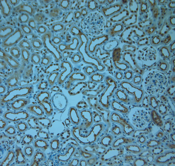 RAB6A/RAB6C Antibody in Immunohistochemistry (Paraffin) (IHC (P))
