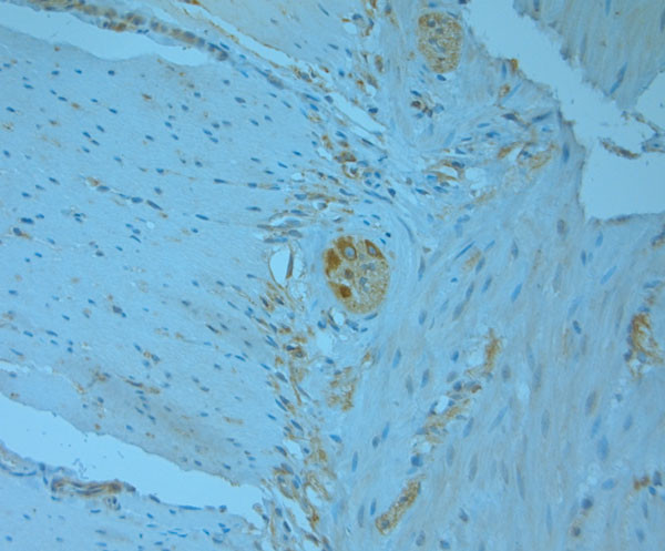 REEP5 Antibody in Immunohistochemistry (Paraffin) (IHC (P))