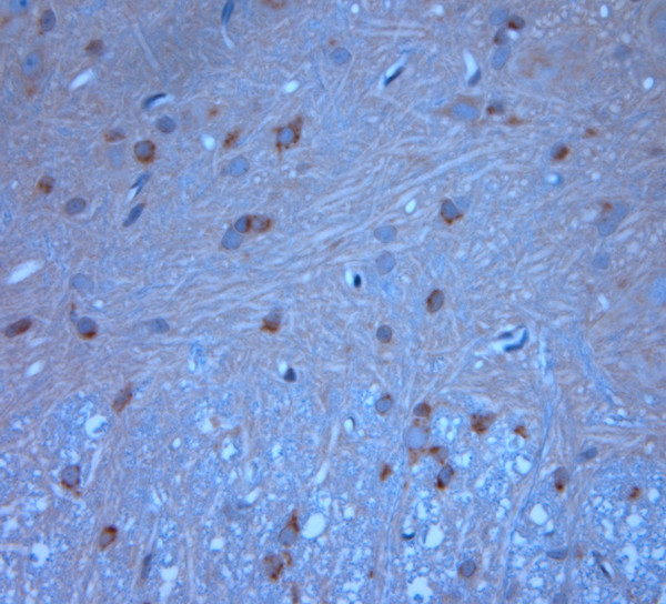 Syntaxin6 Antibody in Immunohistochemistry (Paraffin) (IHC (P))
