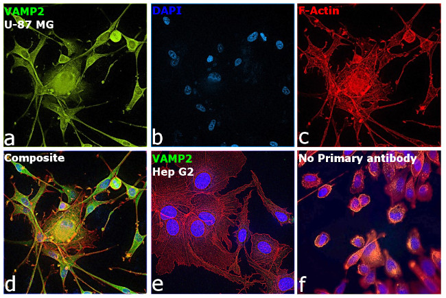 VAMP2 Antibody in Immunocytochemistry (ICC/IF)