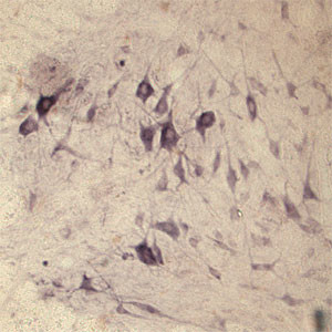 SEC22B Antibody in Immunohistochemistry (IHC)