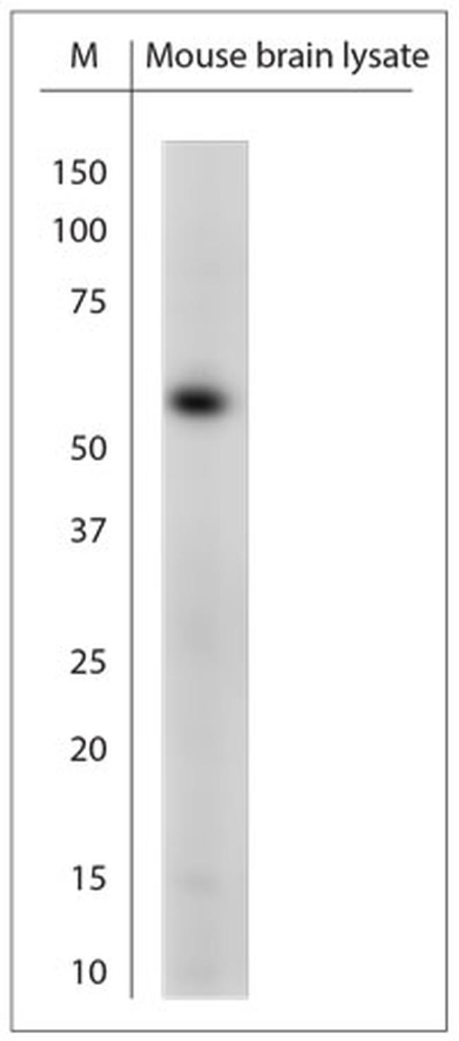 5HT3A R Antibody in Western Blot (WB)