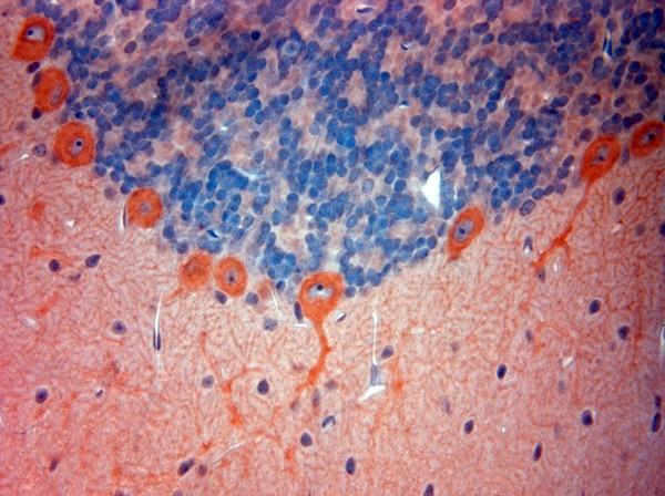 STIM1 Antibody in Immunohistochemistry (Paraffin) (IHC (P))