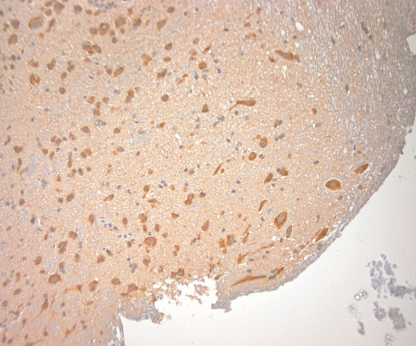 SNAP 47 Antibody in Immunohistochemistry (Paraffin) (IHC (P))