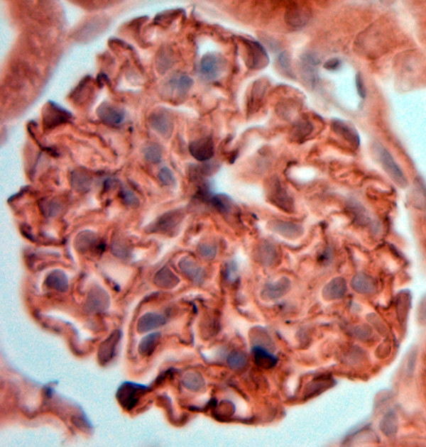 Synaptopodin Antibody in Immunohistochemistry (Paraffin) (IHC (P))
