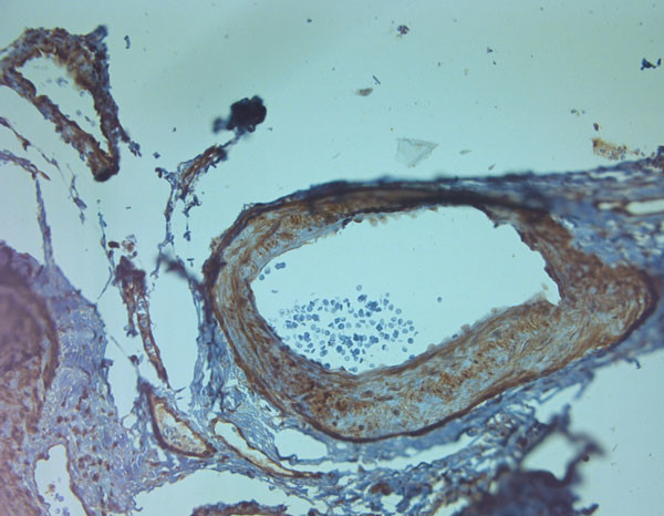 5HT5A R Antibody in Immunohistochemistry (Paraffin) (IHC (P))