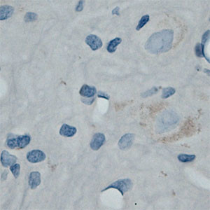 SFT2A Antibody in Immunohistochemistry (Paraffin) (IHC (P))