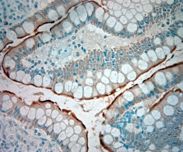 SLC5A8 Antibody in Immunohistochemistry (Paraffin) (IHC (P))
