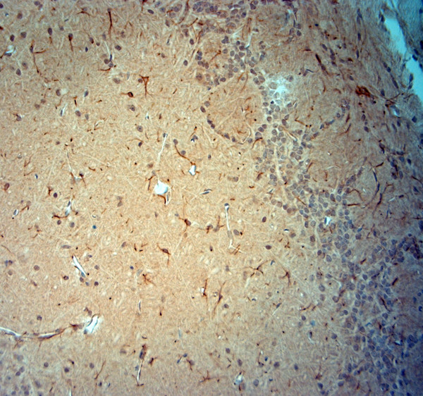 Synaptojanin1 Antibody in Immunohistochemistry (Paraffin) (IHC (P))