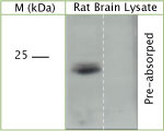 TRAPPC5 Antibody in Western Blot (WB)