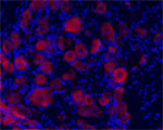 TrkC Antibody in Immunocytochemistry (ICC/IF)