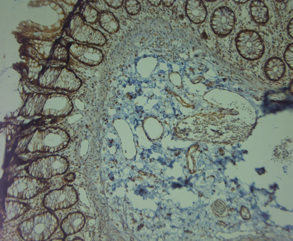 TRPV2 Antibody in Immunohistochemistry (Paraffin) (IHC (P))