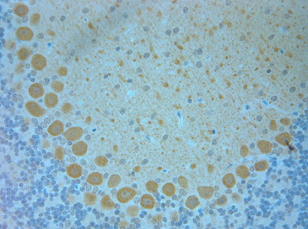 TMEM37 Antibody in Immunohistochemistry (Paraffin) (IHC (P))