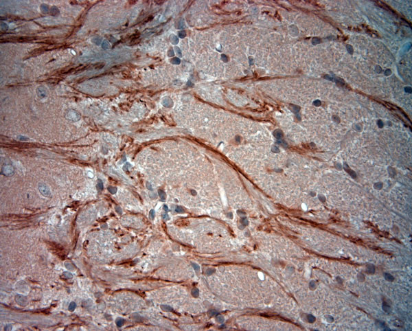 VPS45 Antibody in Immunohistochemistry (Paraffin) (IHC (P))