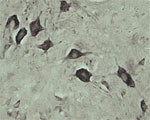 VPS45A Antibody in Immunohistochemistry (IHC)