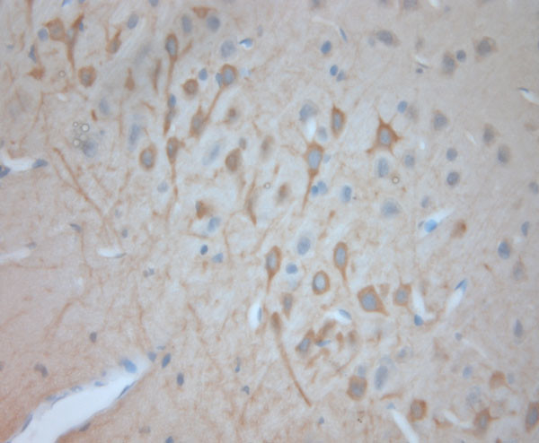 VTI1A Antibody in Immunohistochemistry (Paraffin) (IHC (P))